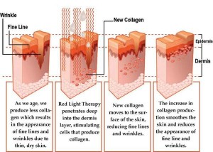 red-light-therapy-results