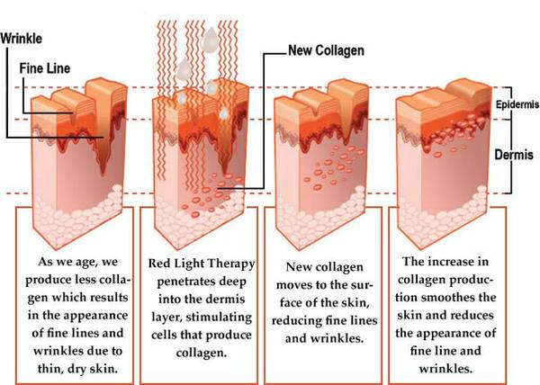 The Anti-aging Skin Benefits Of Red Light Therapy - Shape