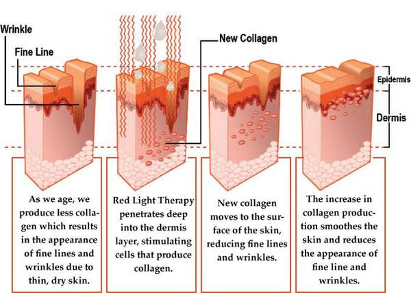 What Laying In An Led Light Therapy Bed Is Really Like - Allure